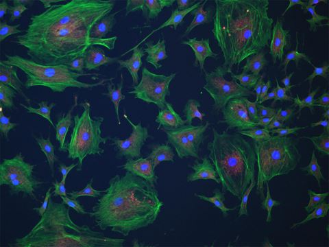 3-channel fluorescence 
