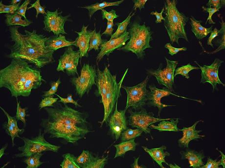JENOPTIK SYIONS® projection - the perfect image Multifluorescence